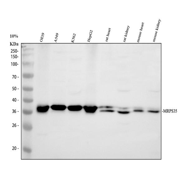 Western blot analysis of MRPS35 using anti-MRPS35 antibody (A13823-2)
