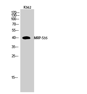 Western Blot analysis of K562 cells using MRP-S35 Polyclonal Antibody