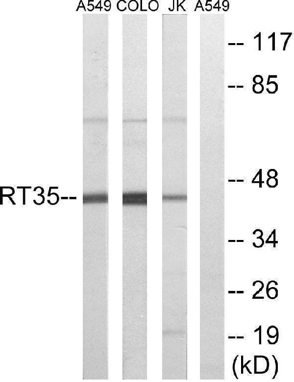 Western blot analysis of lysates from Jurkat, COLO, and A549 cells, using MRPS35 Antibody
