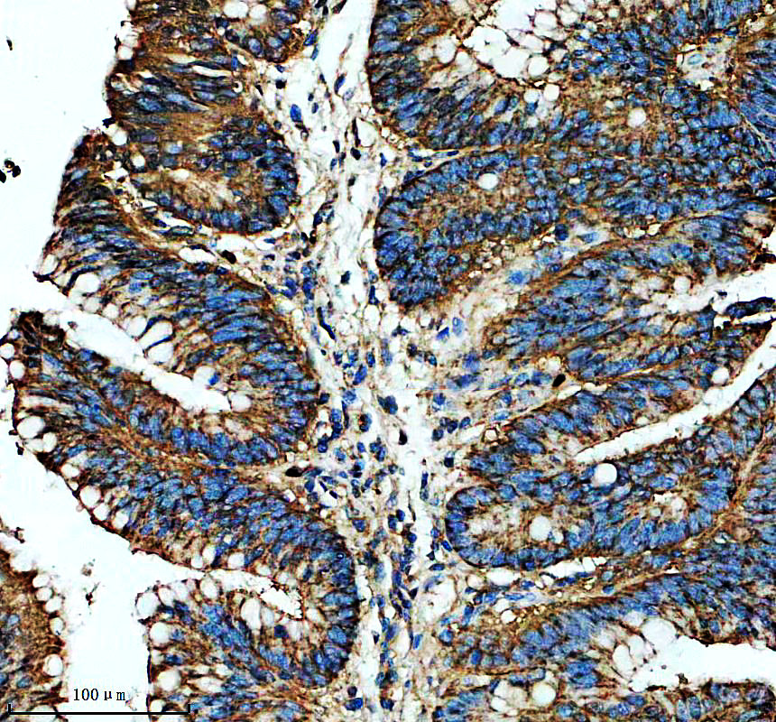 a13824 1 mrps2 primary antibodies ihc testing 1
