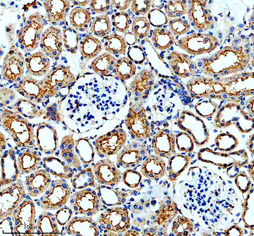 a13824 1 mrps2 primary antibodies ihc testing 2
