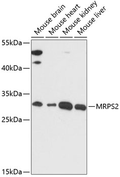Western blot analysis of extracts of various cell lines, using MRPS2 antibody  at 1:3000 dilution