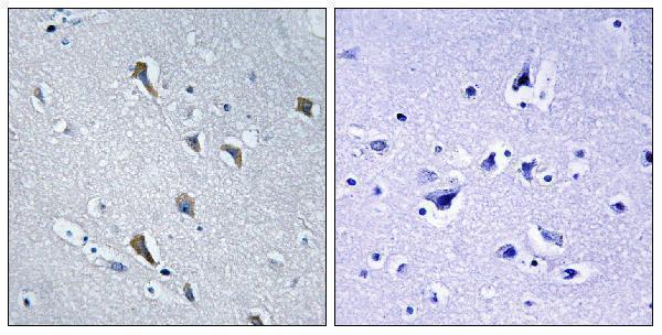Immunohistochemistryt analysis of paraffin-embedded human brain, using MRPS2 Antibody