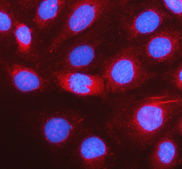 a13825 1 lacc1 primary antibodies if testing 1