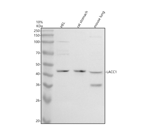 a13825 1 lacc1 primary antibodies wb testing 1