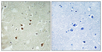 Immunohistochemical analysis of paraffin-embedded Human brain