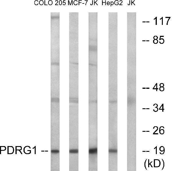 Western blot analysis of lysates from Jurkat, COLO, MCF-7, and HepG2 cells, using PDRG1 Antibody