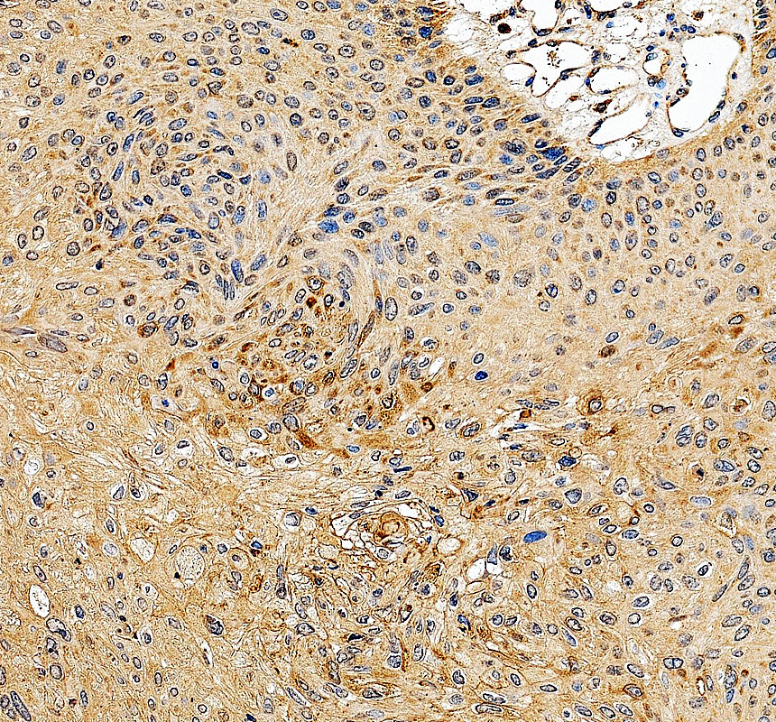 IHC analysis of MAK16 using anti-MAK16 antibody (A13837-1)