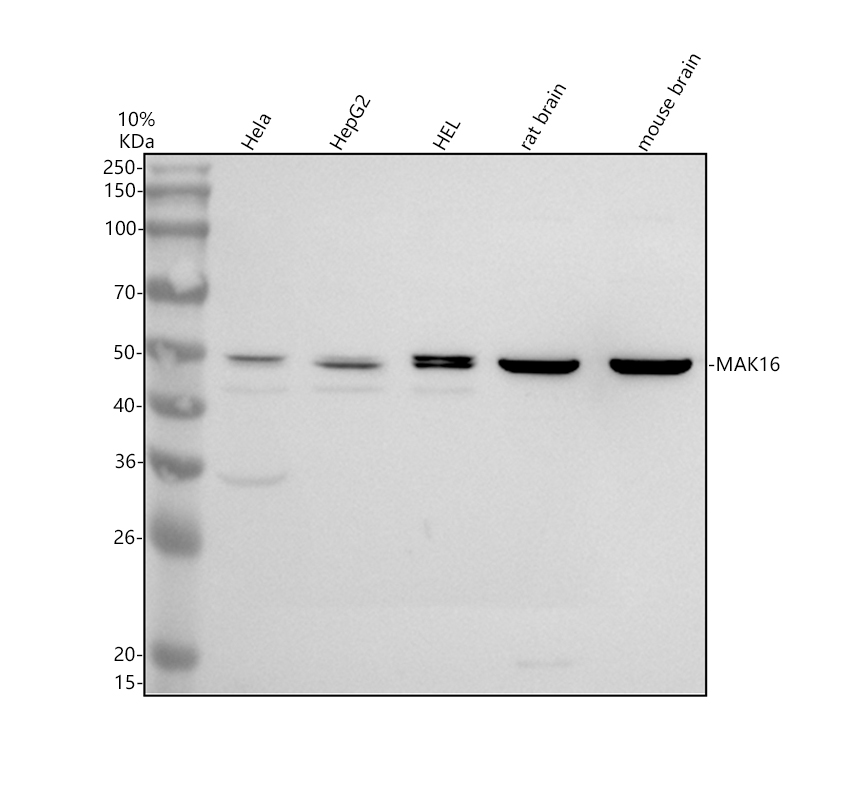 Western blot analysis of MAK16 using anti-MAK16 antibody (A13837-1)