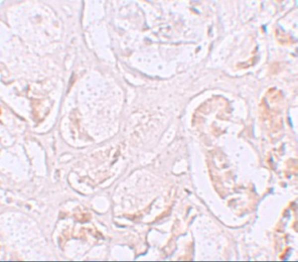 a13838 slamf9 primary antibodies ihc testing 2