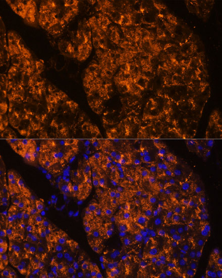 a13846 serpini2 primary antiboties if testing 2