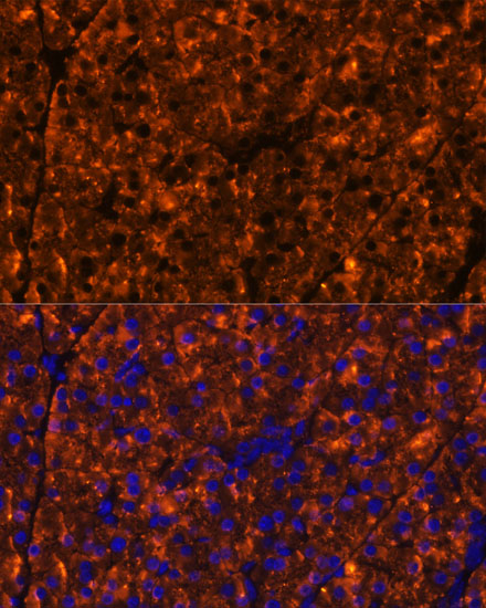 a13846 serpini2 primary antiboties if testing 3