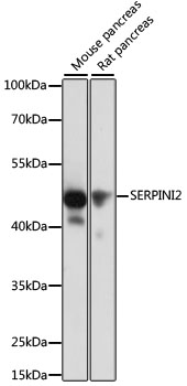 a13846 serpini2 primary antiboties wb testing 1