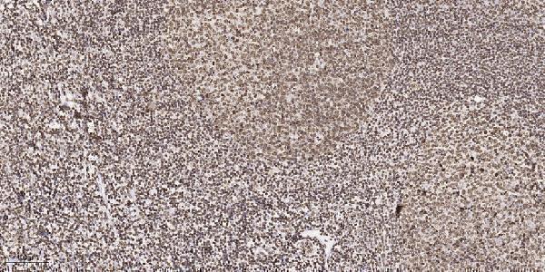a13857 znf397 primary antibodies ihc testing 1