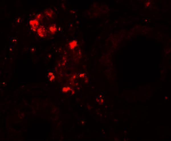 a13880 wdr92 primary antibodies if testing 3