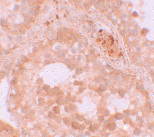 a13880 wdr92 primary antibodies ihc testing 2