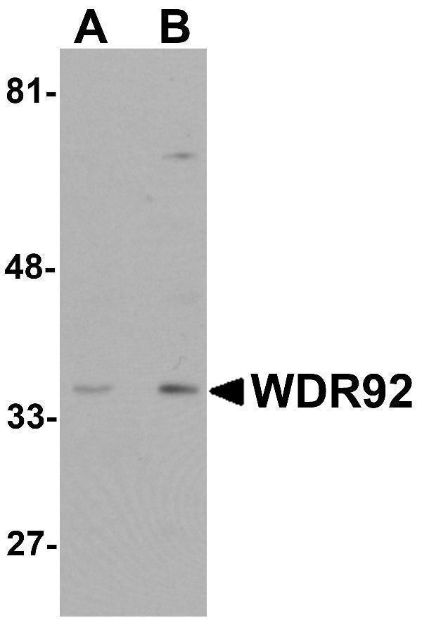 a13880 wdr92 primary antibodies wb testing 1