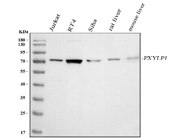 Figure 1. Western blot analysis of ACPL2/PXYLP1 using anti-ACPL2/PXYLP1 antibody (A13883-1). Electrophoresis was performed on a 5-20% SDS-PAGE gel at 70V (Stacking gel) / 90V (Resolving gel) for 2-3 hours. The sample well of each lane was loaded with 30 ug of sample under reducing conditions. Lane 1: human Jurkat whole cell lysates, Lane 2: human RT4 whole cell lysates, Lane 3: human SiHa whole cell lysates, Lane 4: rat liver tissue lysates, Lane 5: mouse liver tissue lysates. After electrophoresis, proteins were transferred to a nitrocellulose membrane at 150 mA for 50-90 minutes. Blocked the membrane with 5% non-fat milk/TBS for 1.5 hour at RT. The membrane was incubated with rabbit anti-ACPL2/PXYLP1 antigen affinity purified polyclonal antibody (Catalog # A13883-1) at 0.5 microg/mL overnight at 4°C, then washed with TBS-0.1%Tween 3 times with 5 minutes each and probed with a goat anti-rabbit IgG-HRP secondary antibody at a dilution of 1:5000 for 1.5 hour at RT. The signal is developed using an Enhanced Chemiluminescent detection (ECL) kit (Catalog # EK1002) with Tanon 5200 system. A specific band was detected for ACPL2/PXYLP1 at approximately 70 kDa. The expected band size for ACPL2/PXYLP1 is at 55 kDa.