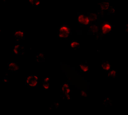 a13892 klhl15 primary antibodies if testing 3