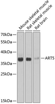 Western blot analysis of extracts of various cell lines, using ART5 antibody  at 1:1000 dilution