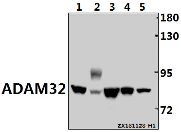 Western blot (WB) analysis of ADAM32 (N530) polyclonal antibody at 1:500 dilution
Lane1:BV2 whole cell lysate(40ug)
Lane2:The Testis tissue lysate of Rat(40ug)
Lane3:MCF-7 whole cell lysate(40ug)
Lane4:Hela whole cell lysate(20ug)
Lane5:U-87MG whole cell lysate(30ug)