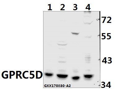 Western blot (WB) analysis of GPRC5D pAb at 1:500 dilution
Lane1:SGC7901 whole cell lysate(40ug)
Lane2:PANC1 whole cell lysate(40ug)
Lane3:CT26 whole cell lysate(40ug)
Lane4:PC12 whole cell lysate(40ug)