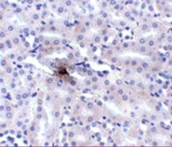 a13919 slc39a11 primary antibodies ihc testing 2
