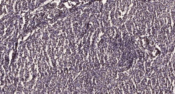 Immunohistochemical analysis of paraffin-embedded human brain tumor