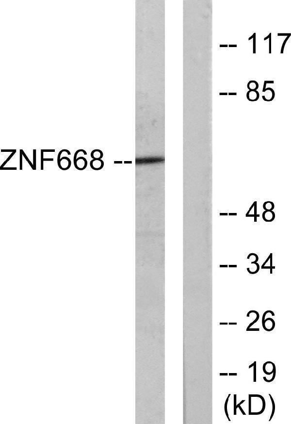 Western blot analysis of lysates from Jurkat cells, using ZNF668 Antibody