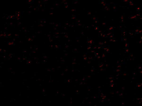 a13956 lrrc1 primary antibodies if testing 3