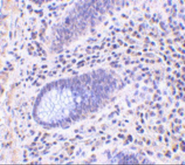 a13956 lrrc1 primary antibodies ihc testing 2
