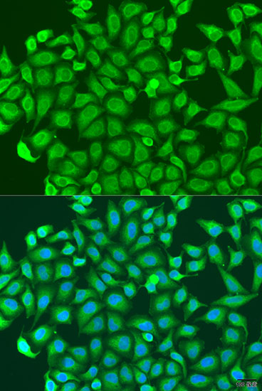 a13958 pcdha6 primary antiboties if testing 2