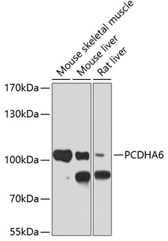 a13958 pcdha6 primary antiboties wb testing 1