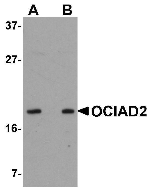 Western blot analysis of OCIAD2 in SK-N-SH cell lysate with OCIAD2 antibody at (A) 0