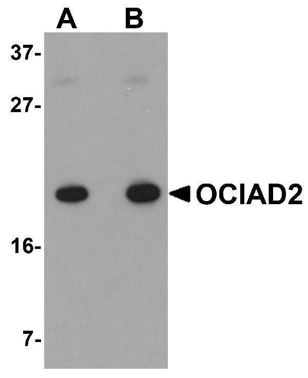 Western blot analysis of OCIAD2 in A549 cell lysate with OCIAD2 antibody at (A) 0