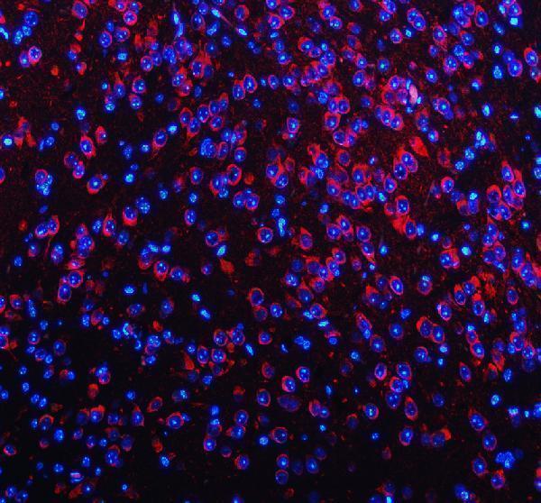 a13973 1 necab1 primary antibodies if testing 1