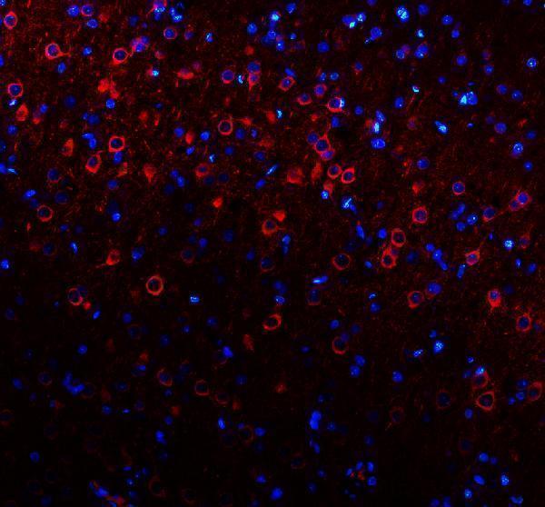 a13973 1 necab1 primary antibodies if testing 2