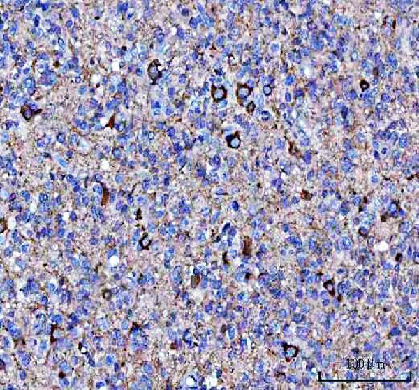 a13973 1 necab1 primary antibodies ihc testing 1