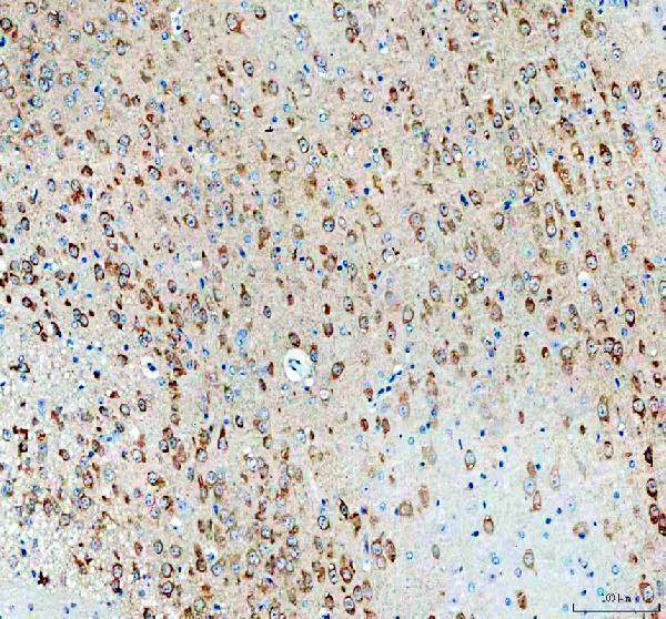 a13973 1 necab1 primary antibodies ihc testing 2_1