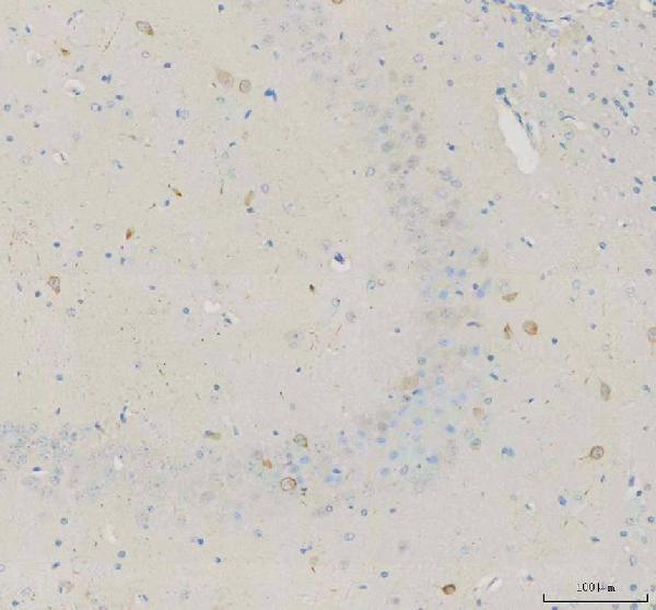 a13973 1 necab1 primary antibodies ihc testing 3_1