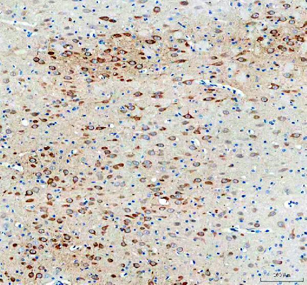 a13973 1 necab1 primary antibodies ihc testing 4_1