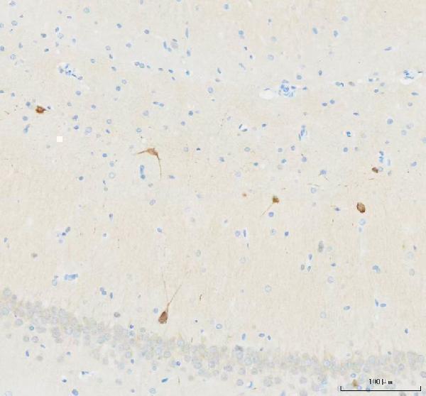 a13973 1 necab1 primary antibodies ihc testing 5