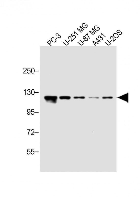 All lanes : Anti-K0746 Antibody (N-term) at 1:1000 dilution Lane 1: PC-3 whole cell lysate Lane 2: U-251 MG whole cell lysate Lane 3: U-87 MG whole cell lysate Lane 4: A431 whole cell lysate Lane 5: U-2OS whole cell lysate Lysates/proteins at 20 microg per lane. Secondary Goat Anti-Rabbit IgG, (H+L), Peroxidase conjugated at 1/10000 dilution. Predicted band size : 125 kDa Blocking/Dilution buffer: 5% NFDM/TBST.