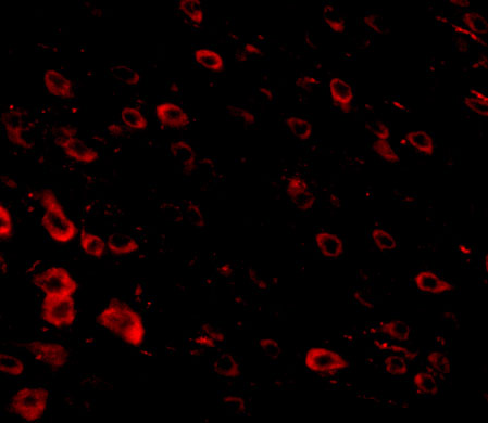 a13983 lrfn3 primary antibodies if testing 3