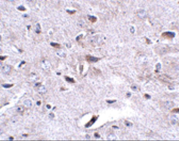 a13983 lrfn3 primary antibodies ihc testing 2