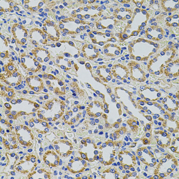 Immunohistochemistry of paraffin-embedded rat kidney using TRMT2A/HTF9C antibody  at dilution of 1:100 