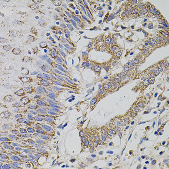 Immunohistochemistry of paraffin-embedded human esophagus using TRMT2A/HTF9C antibody  at dilution of 1:100 