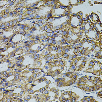 a13996 trmt2a primary antiboties ihc testing 4