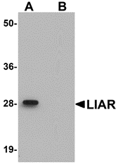 Western blot analysis of LIAR in mouse kidney tissue lysate with LIAR antibody at 1 μg/mL in (A) the absence and (B) the presence of blocking peptide