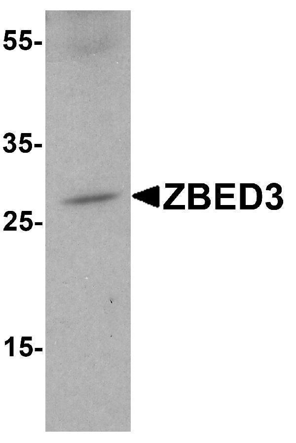 a14001 1 zbed3 primary antibodies wb testing 1